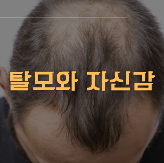 탈모와 자신감 - 신체 이미지와 정서적 영향이미지