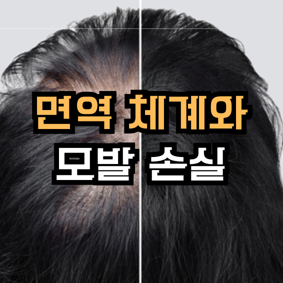 면역 체계와 모발 손실 - 면역 기능과 모발 건강의 연결이미지