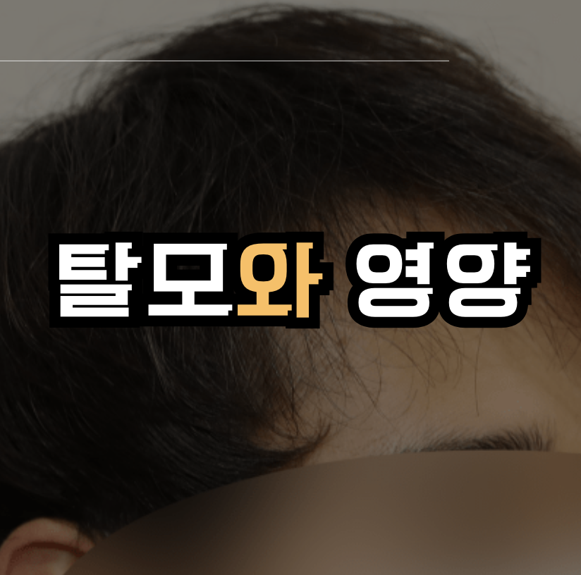 탈모와 영양 - 무엇을 먹으면 좋을까? 썸네일