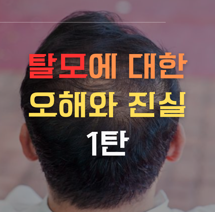 탈모에 대한 오해와 진실 - 1탄이미지