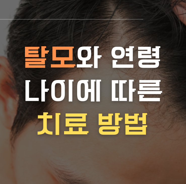 탈모와 연령: 나이에 따른 치료 방법이미지